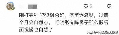 ​49岁林心如大变样，脸超肿，连酒窝被淹没，网友辣评：医美后遗症