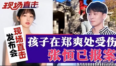 ​郑爽露面做慈善心情好，穿短裙膝盖淤青明显，脚穿名牌靴子引热议