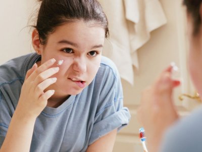 ​额头老是长痘痘怎么回事