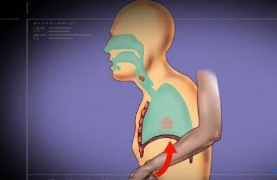 ​痛心！开封4岁男童因肉丸子送了命，3分钟换孩子一份安全