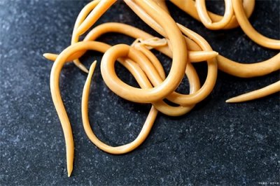 ​八九十年代，几乎人人肚子里都有蛔虫，为何现在没有了？一文说清