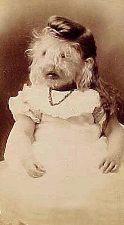 图揭19世纪“怪胎” 身体畸形诡异神秘