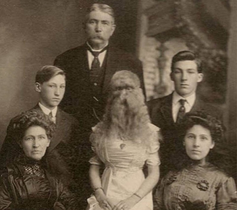 图揭19世纪“怪胎” 身体畸形诡异神秘